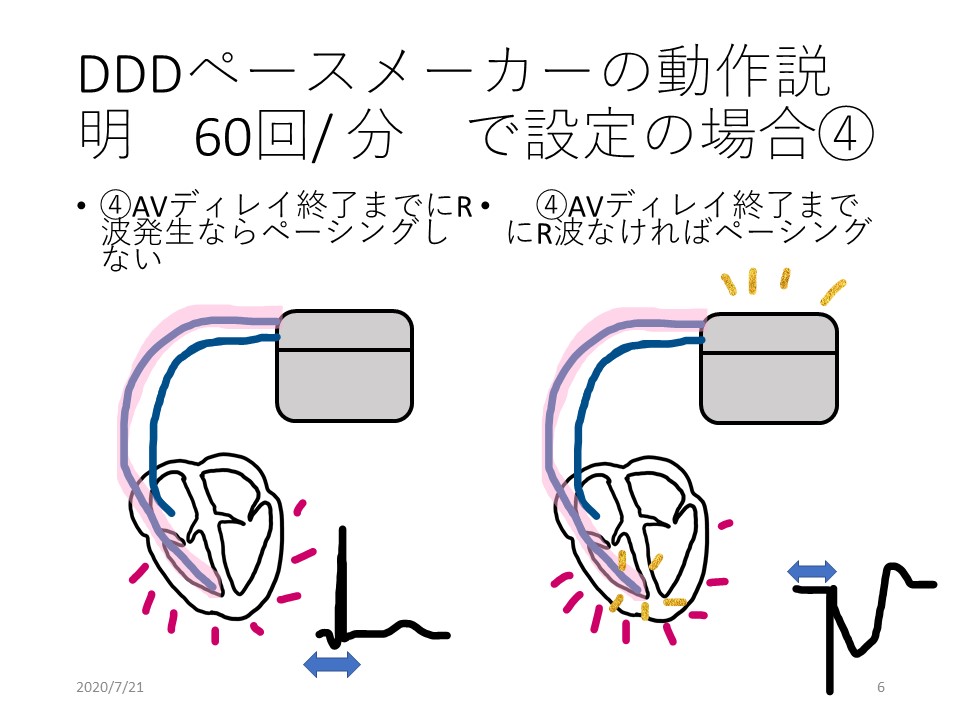 f:id:physicsforCE:20200721124646j:plain f:id:physicsforCE:20200721124646j:plain