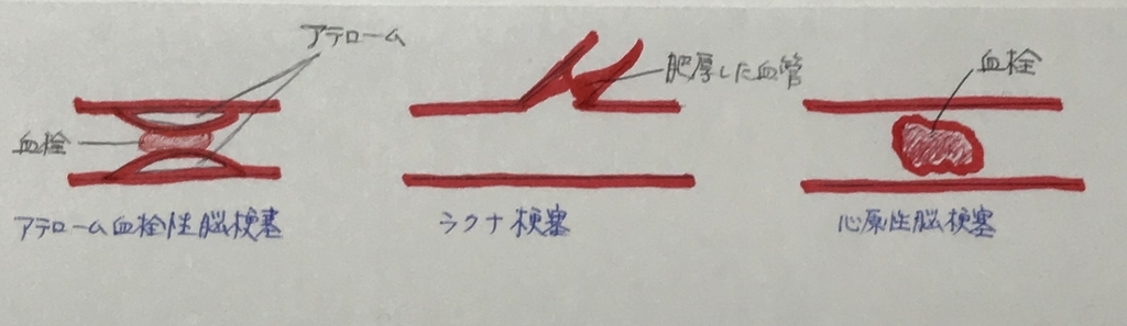 f:id:piano1228:20190219234657j:plain f:id:piano1228:20190219234657j:plain