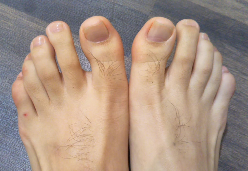 男だけどフットケアサロンで足裏の角質と爪のケアを初体験した話 ピコシムのブログ 男だけどフットケアサロンで足裏の角質と爪のケアを初体験した話 ピコシムのブログ