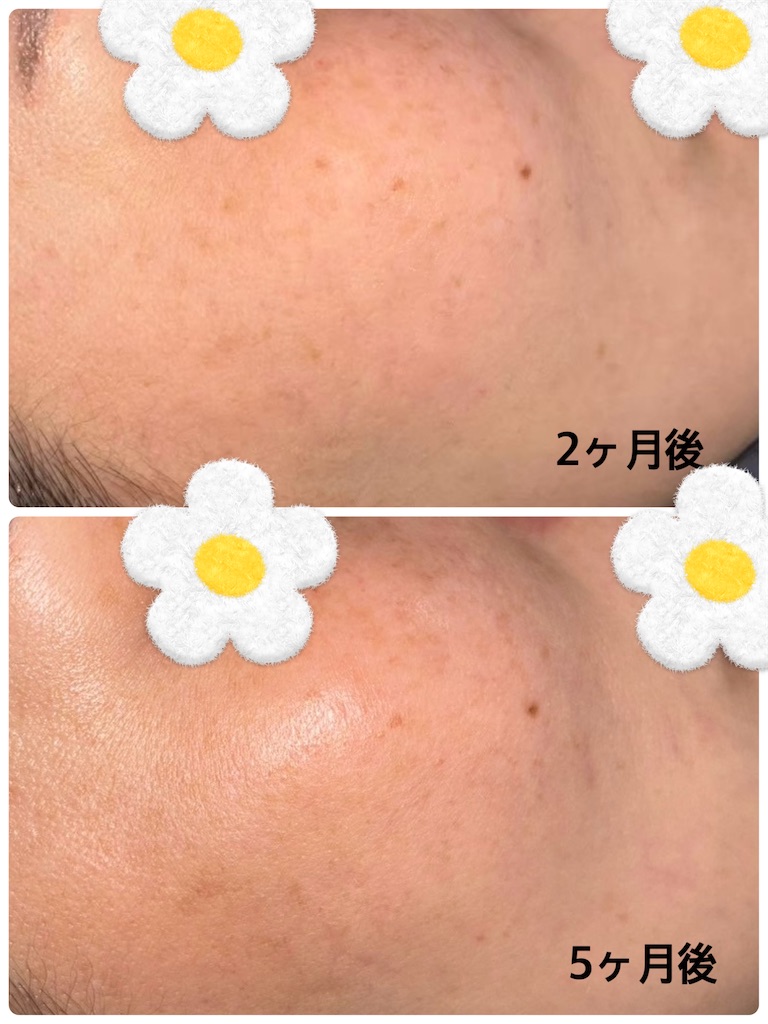 f:id:piko99:20250820165027j:image