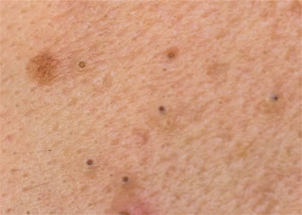 f:id:piricammm:20200913131354j:image