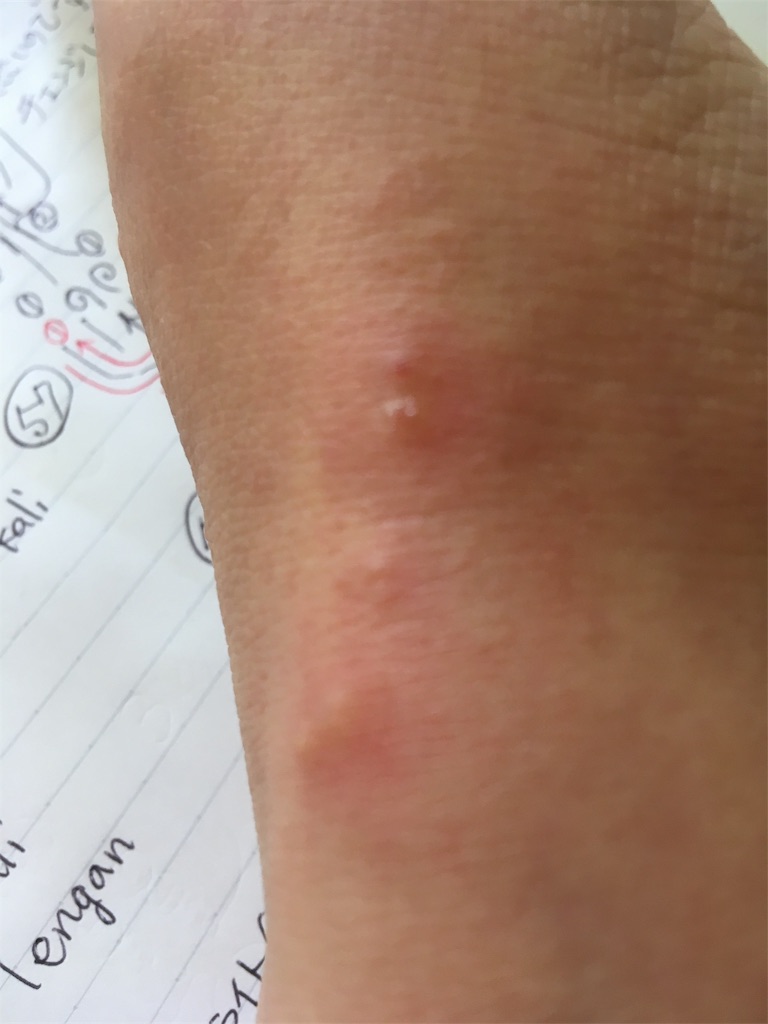 f:id:pjteratai:20190517204515j:image f:id:pjteratai:20190517204515j:image