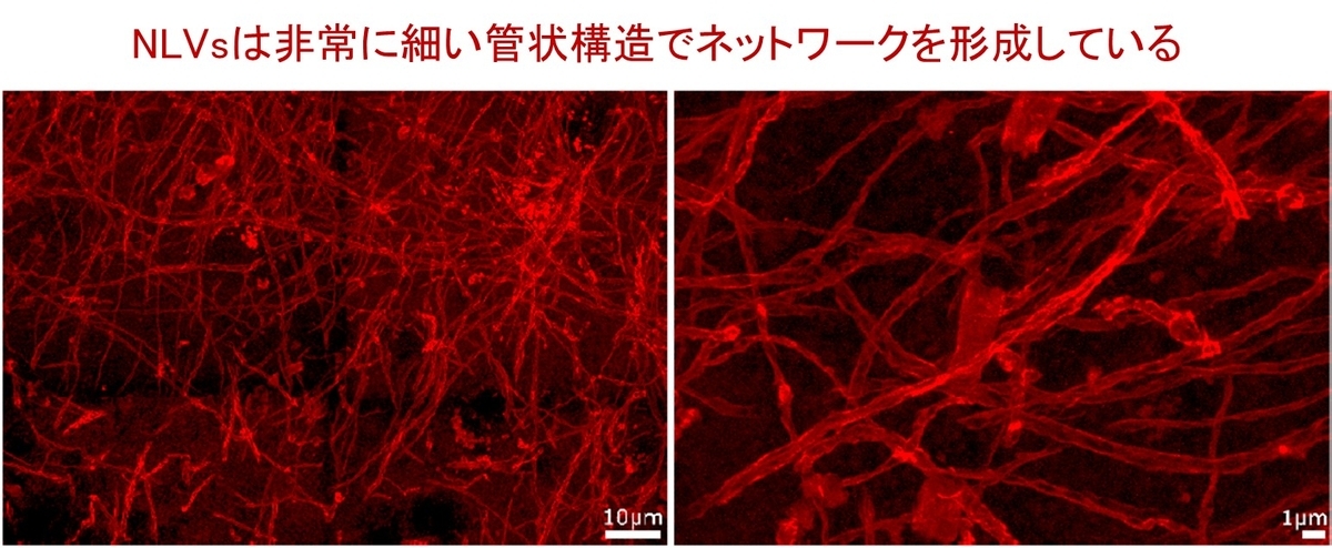 脳内 Glymphatic systemの次に来る大発見！？ ― 脳内ナノスケールリンパ管様