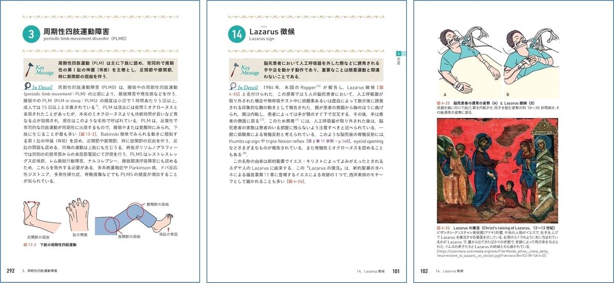 神経症候学 2 神経症候学 改訂第二版 Ⅰ・Ⅱ (平山惠造) / 古本、中古本、古書籍の