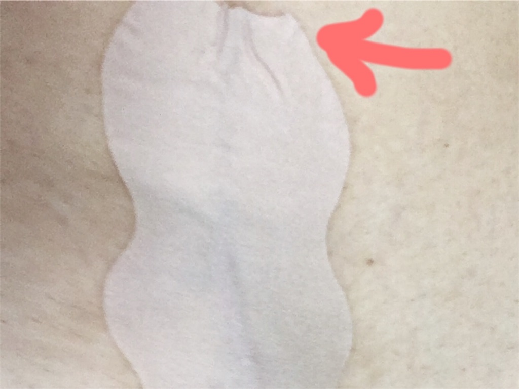 口コミで高評価の アトファイン で帝王切開ケアをしてみたら うちの子育て ちょっと聞いて