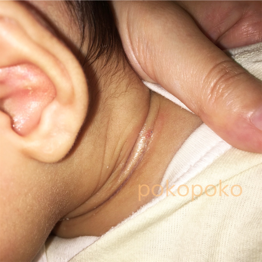 f:id:pokopokomemo:20181207222956j:plain