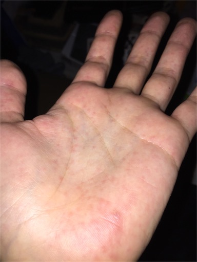 f:id:ponlab-blog:20160322192349j:image