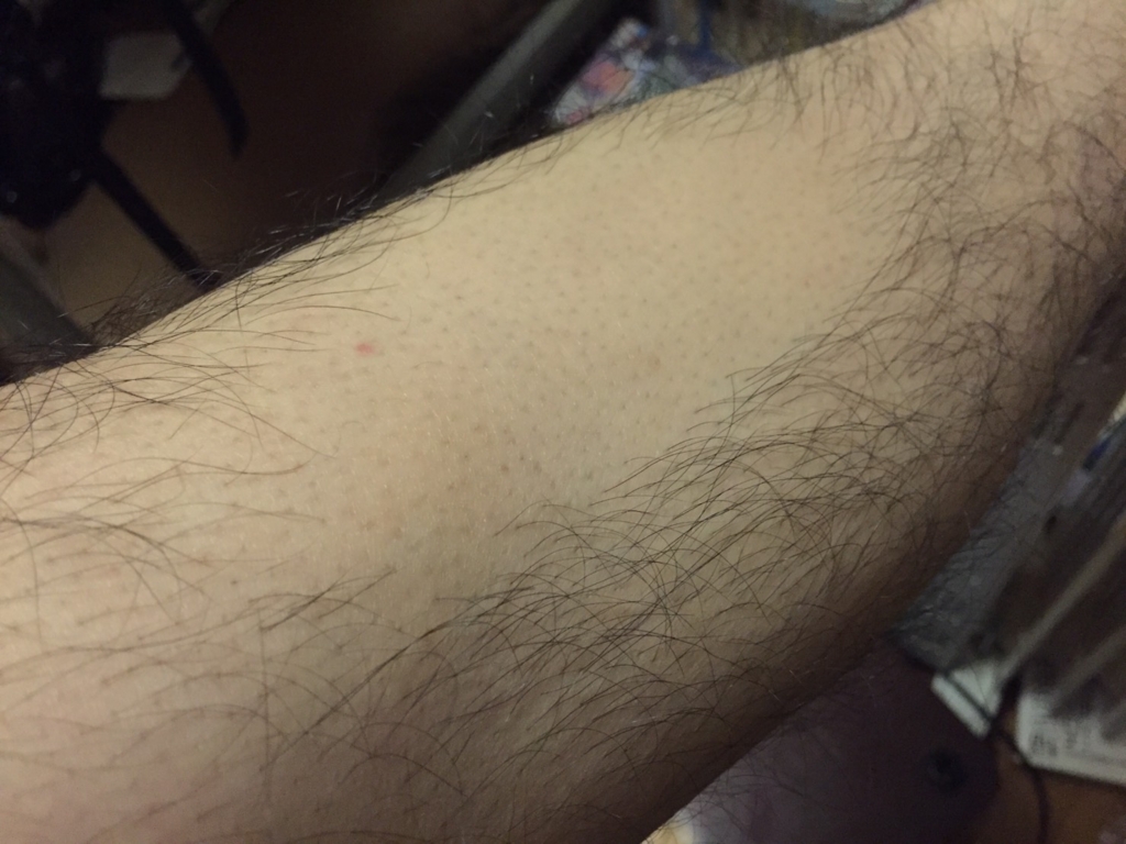 f:id:ponlab-blog:20170517034452j:plain