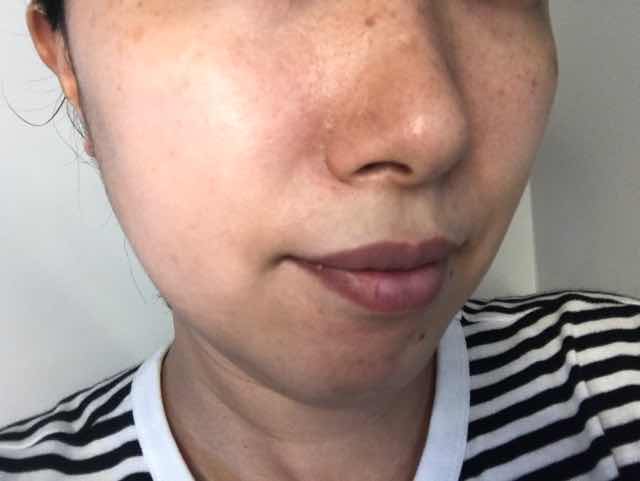 ネオ ちゅら び は だ