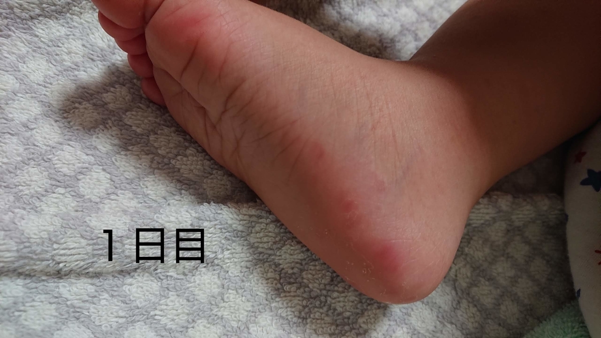 f:id:popainotaoru:20190908135428j:plain