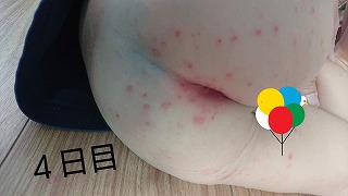 f:id:popainotaoru:20190908142248j:plain