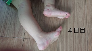 f:id:popainotaoru:20190908142311j:plain