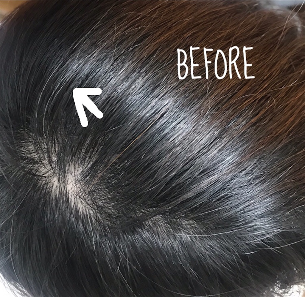 f:id:popopodisco:20181205092854j:image f:id:popopodisco:20181205092854j:image