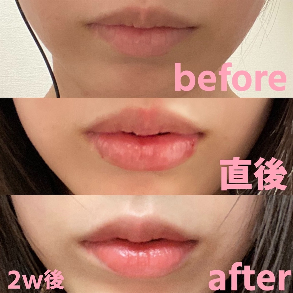 f:id:posuposupaaan:20221107003118j:image