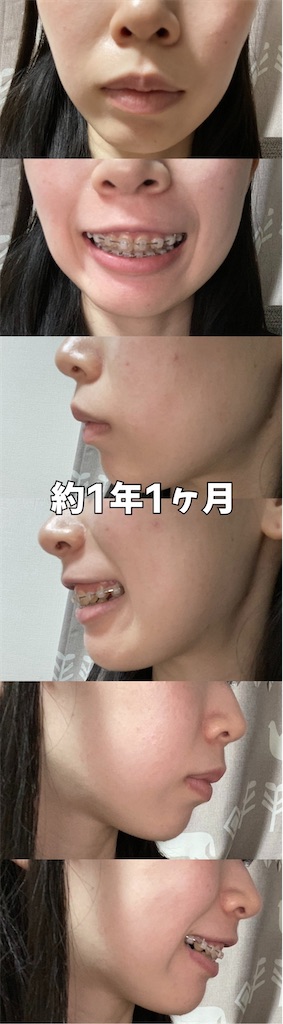 f:id:posuposupaaan:20230303130148j:image
