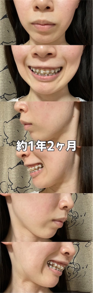f:id:posuposupaaan:20230303130155j:image