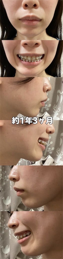 f:id:posuposupaaan:20230303130210j:image