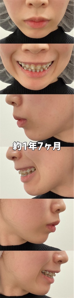 f:id:posuposupaaan:20230303130218j:image