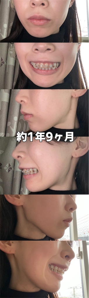 f:id:posuposupaaan:20230303130225j:image