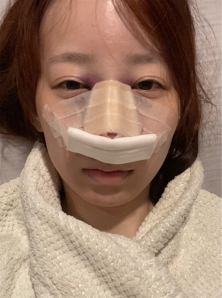 f:id:posuposupaaan:20230907024528j:image