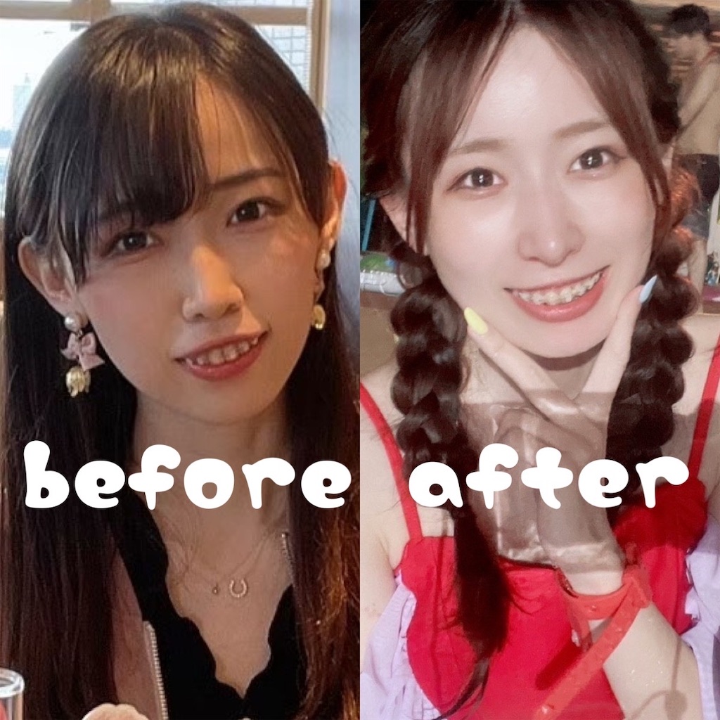f:id:posuposupaaan:20230907024715j:image