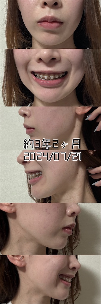 f:id:posuposupaaan:20240904191609j:image