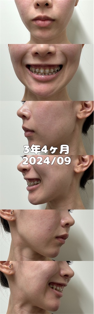 f:id:posuposupaaan:20240913163416j:image