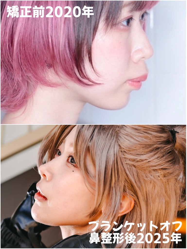 f:id:posuposupaaan:20250301001607j:image
