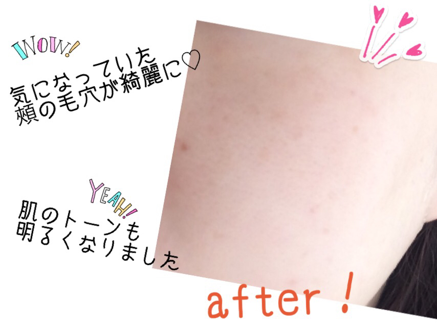 f:id:poyohiyo:20171003121014p:plain