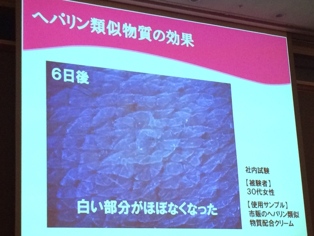 f:id:poyohiyo:20171231012802j:plain