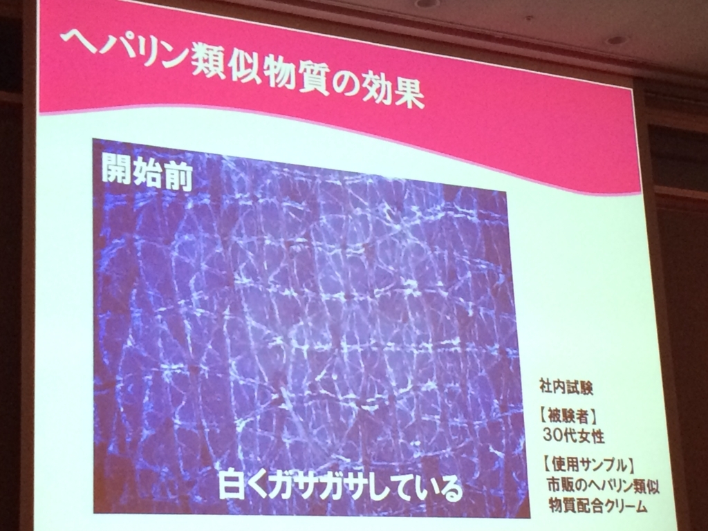 f:id:poyohiyo:20171231142848j:plain