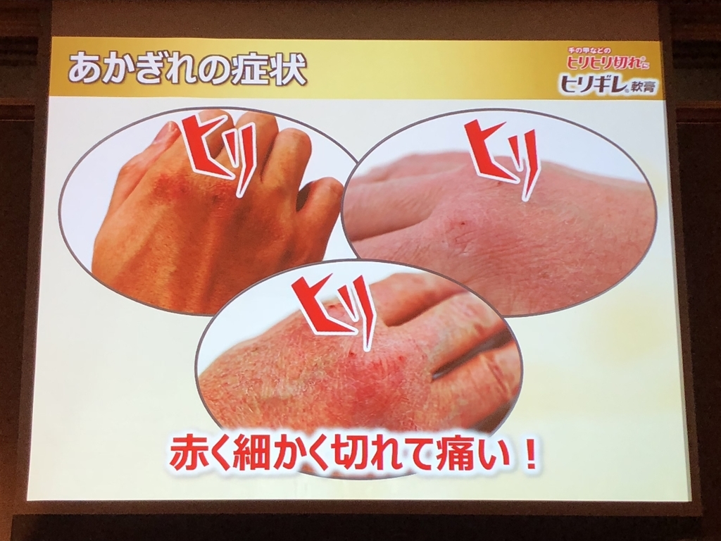 f:id:poyohiyo:20181222084934j:plain