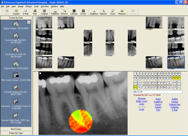 f:id:practiceorthodontic:20190729190627p:plain