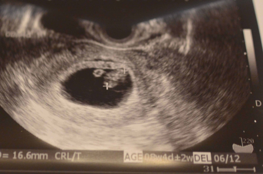 f:id:prepapayuyu:20161106213215j:plain