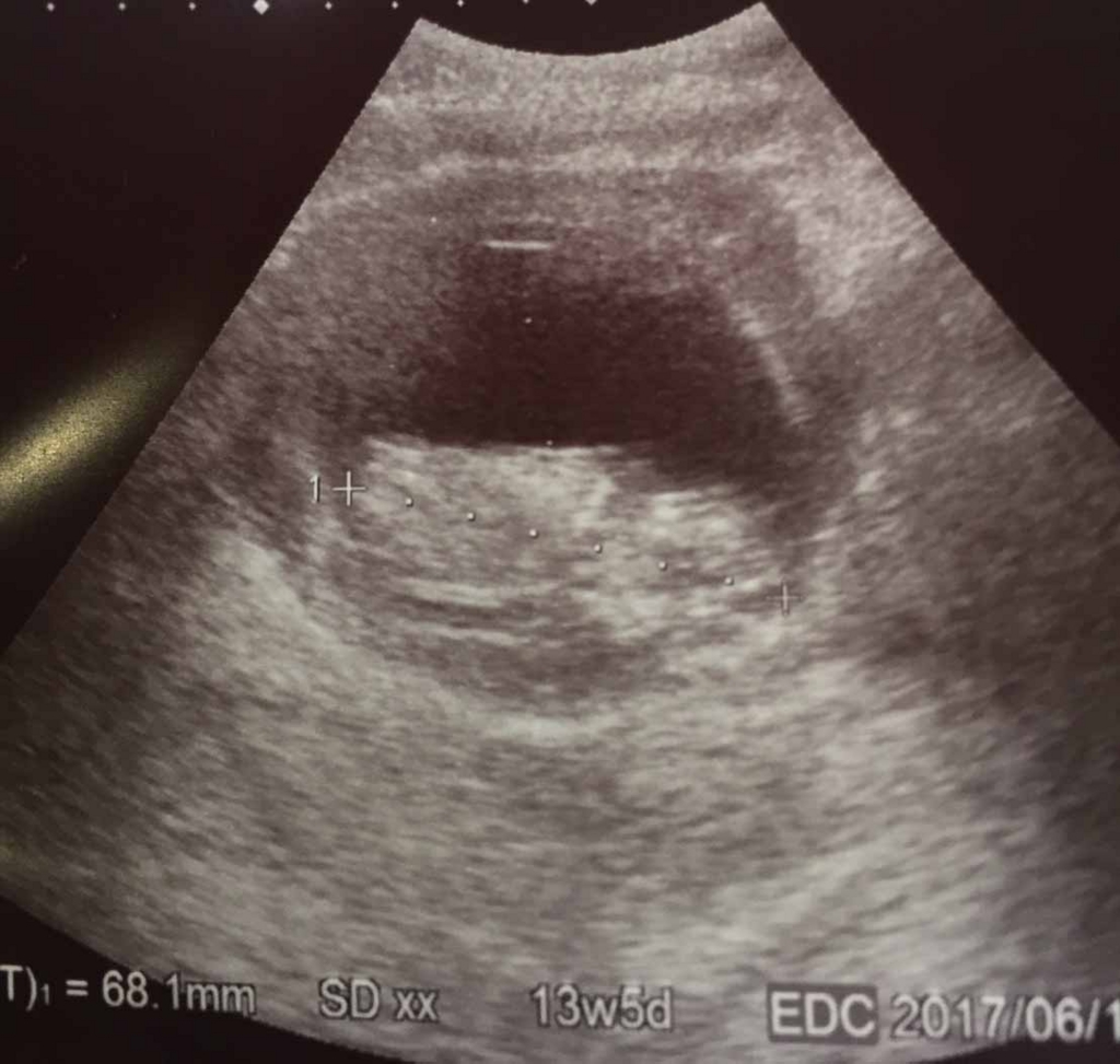 f:id:prepapayuyu:20161211213534j:plain