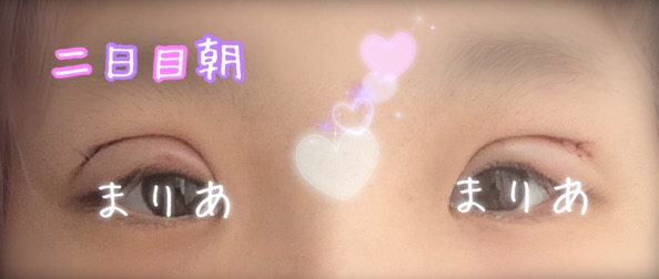 f:id:princessnoowri:20170420202406j:plain f:id:princessnoowri:20170420202406j:plain