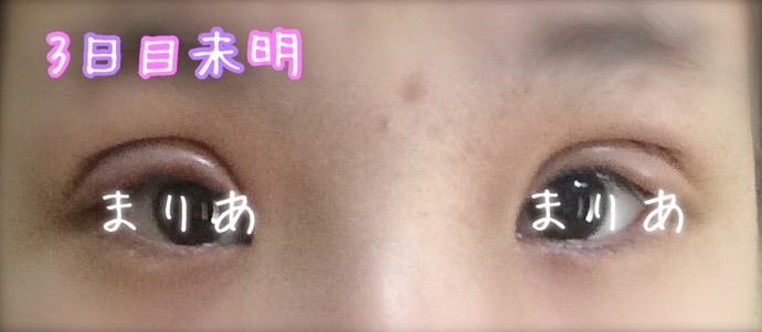 f:id:princessnoowri:20170420202747j:plain f:id:princessnoowri:20170420202747j:plain