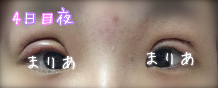 f:id:princessnoowri:20170420203049j:plain f:id:princessnoowri:20170420203049j:plain