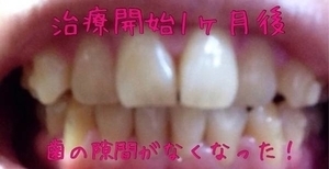 f:id:psaori:20181007102100j:plain f:id:psaori:20181007102100j:plain