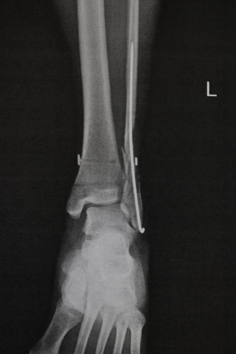 f:id:psato7:20200215191940j:plain