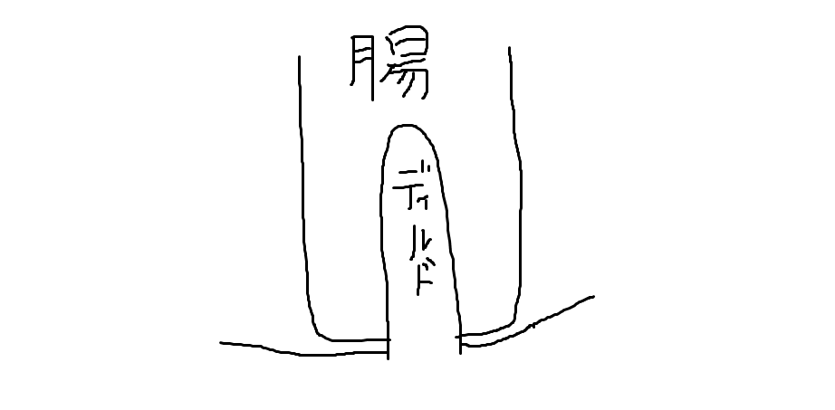 f:id:ptrst:20171213020820p:plain