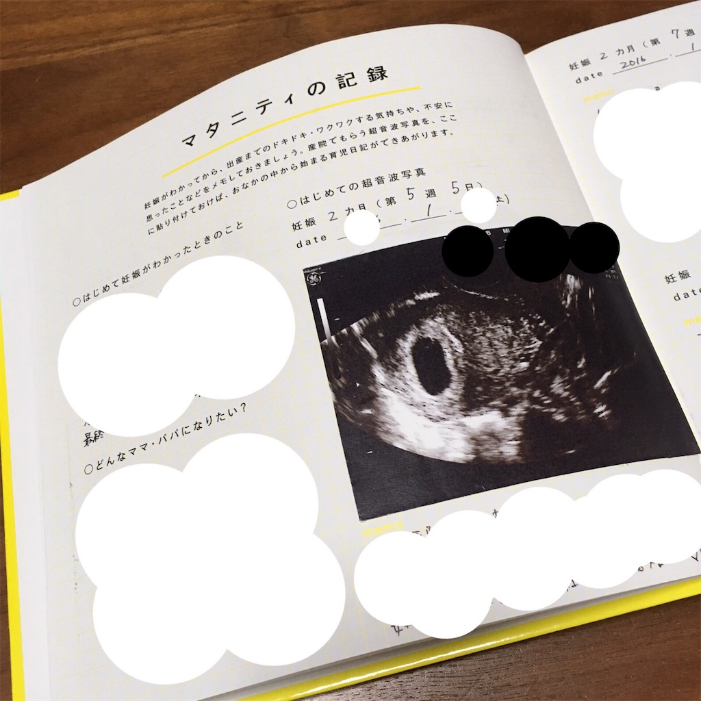 赤すぐオリジナル育児日記 Puchan Diaryのブログ 赤すぐオリジナル育児日記 Puchan Diaryのブログ