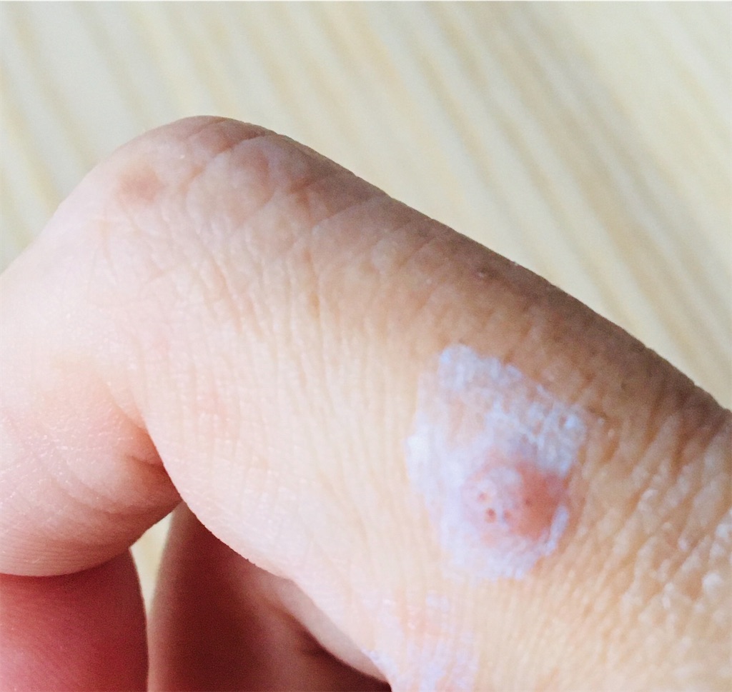 ぷにの北フランス日記