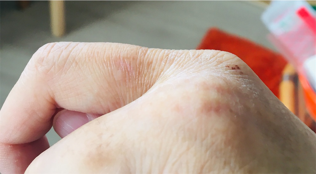 ぷにの北フランス日記