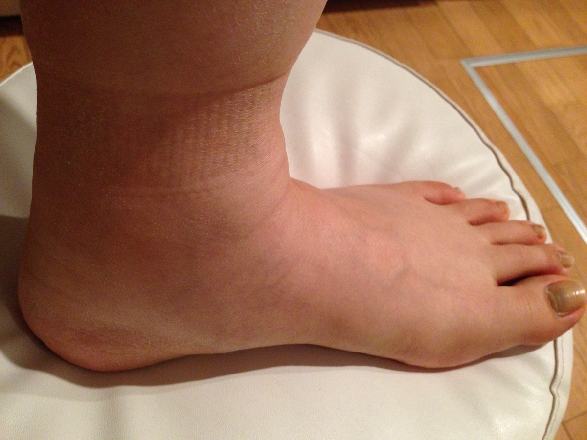 f:id:purikoko:20201204154140j:plain