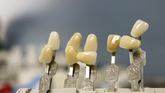 体験談 歯科矯正をして大変だったこと３選 ぷりま