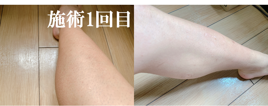 f:id:purinnchan:20210805135948p:plain