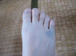 小指.jpg