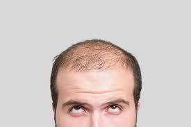 f:id:qcopywrite:20170903192435p:plain