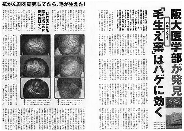 f:id:qcopywrite:20171023183706p:plain